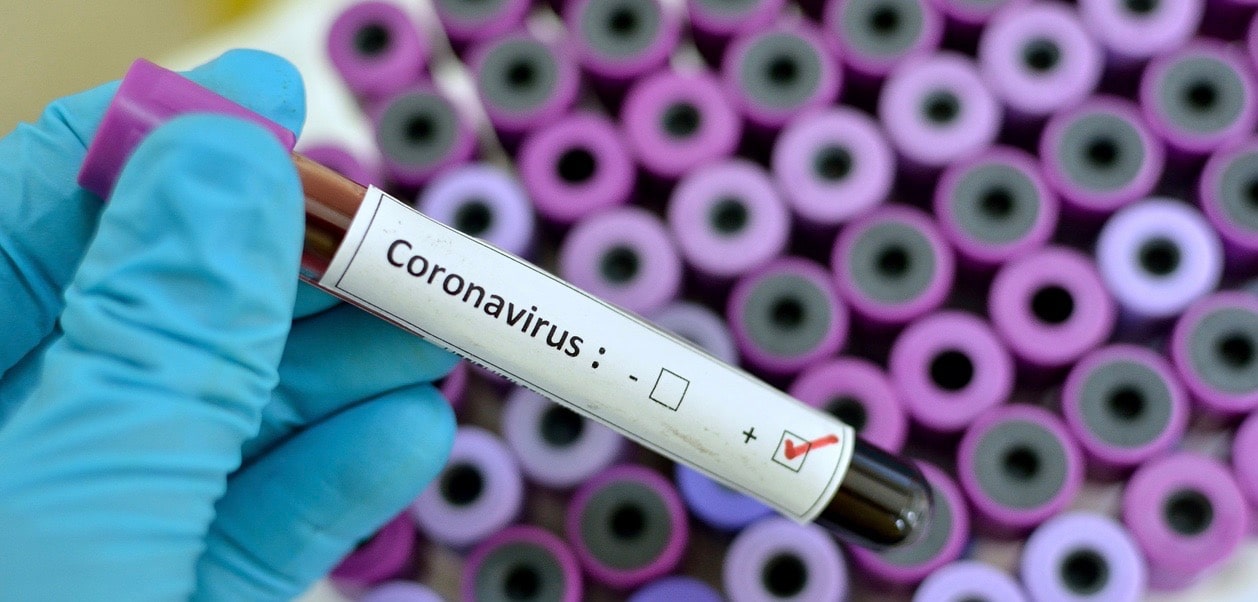 Blood sample with respiratory coronavirus positive